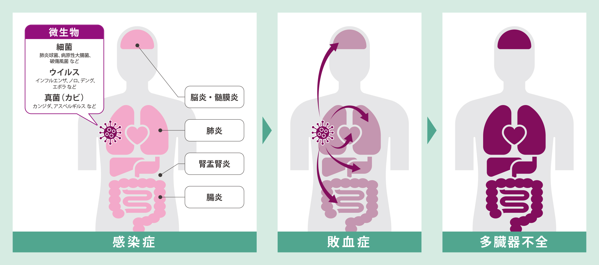 敗血症の前兆は？